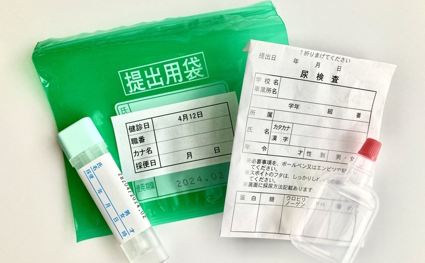 尿検査のキット